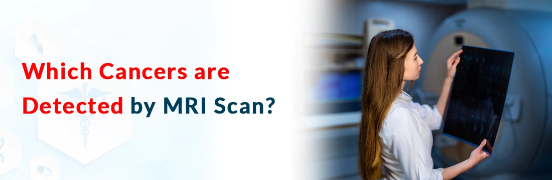  Which Cancers are Detected by MRI Scan?